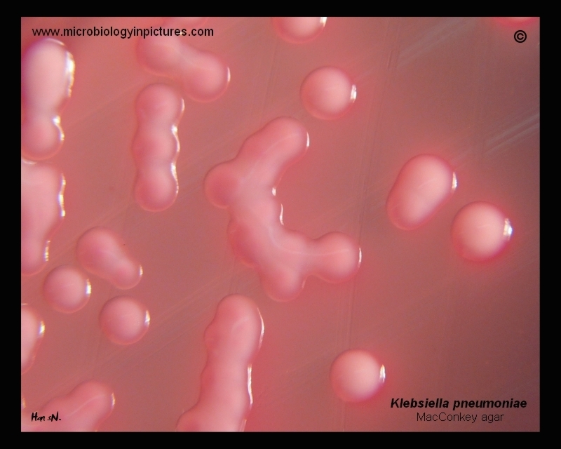 K.pneumoniae growing on MacConkey